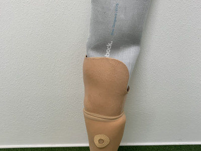 Protéza po amputaci v bérci včetně silikonového návleku Ergona